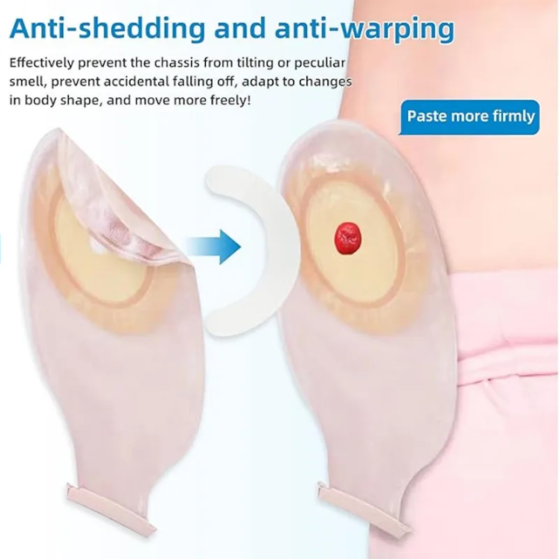 Medical Ostomy Bag Reinforceme - Medical Tape ulasan dan harga